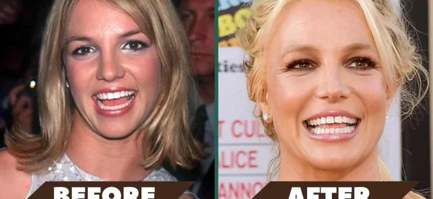 What Happened To Britney Spears' Teeth? Why Does She Have A Tooth Gap ...