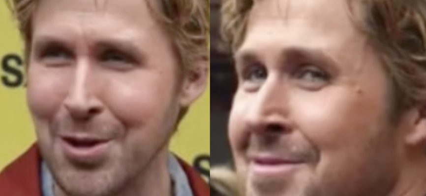 What Happened To Ryan Gosling Face Filler Rumor -
